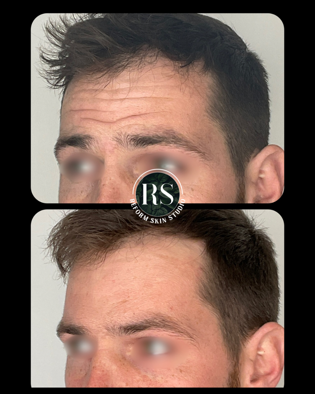 Client before and after image 1