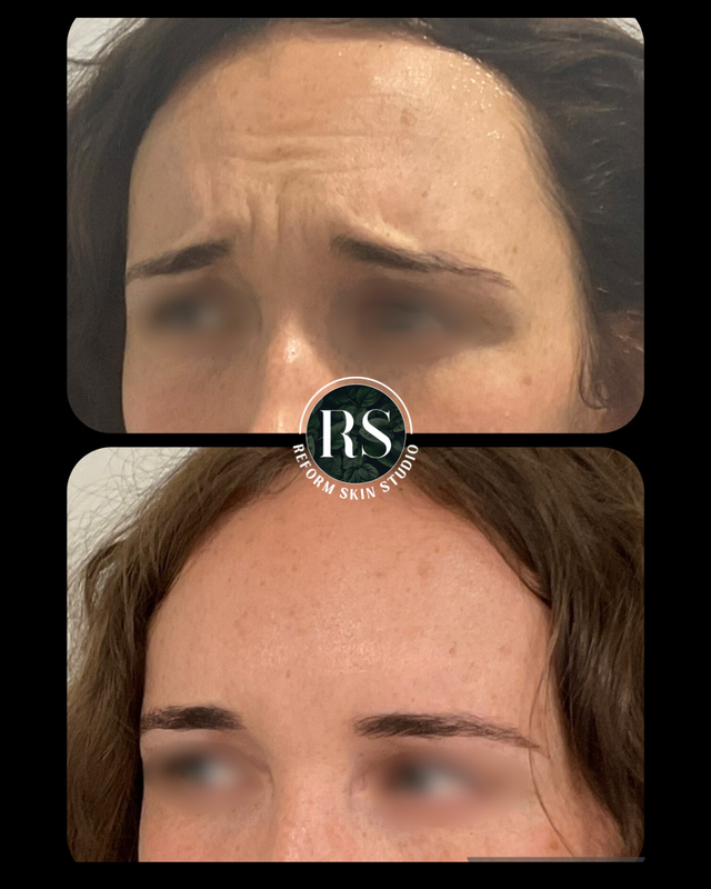 Client before and after image 2
