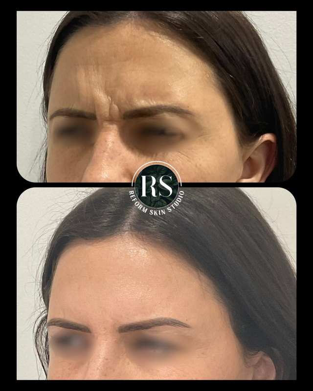 Client before and after image 3