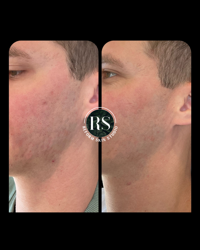 Client before and after image 4