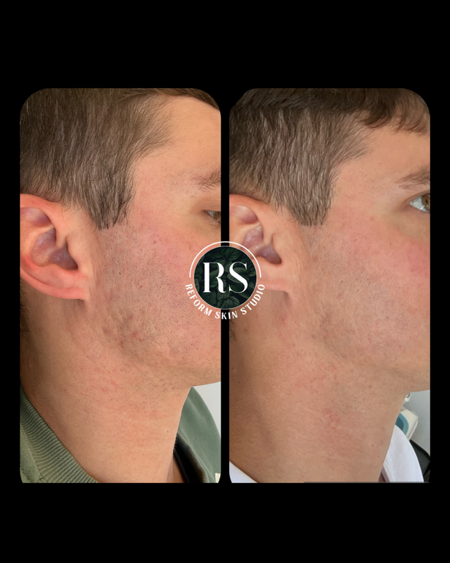 Client before and after image 5