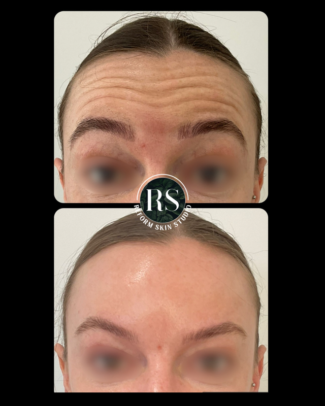 Client before and after image 6