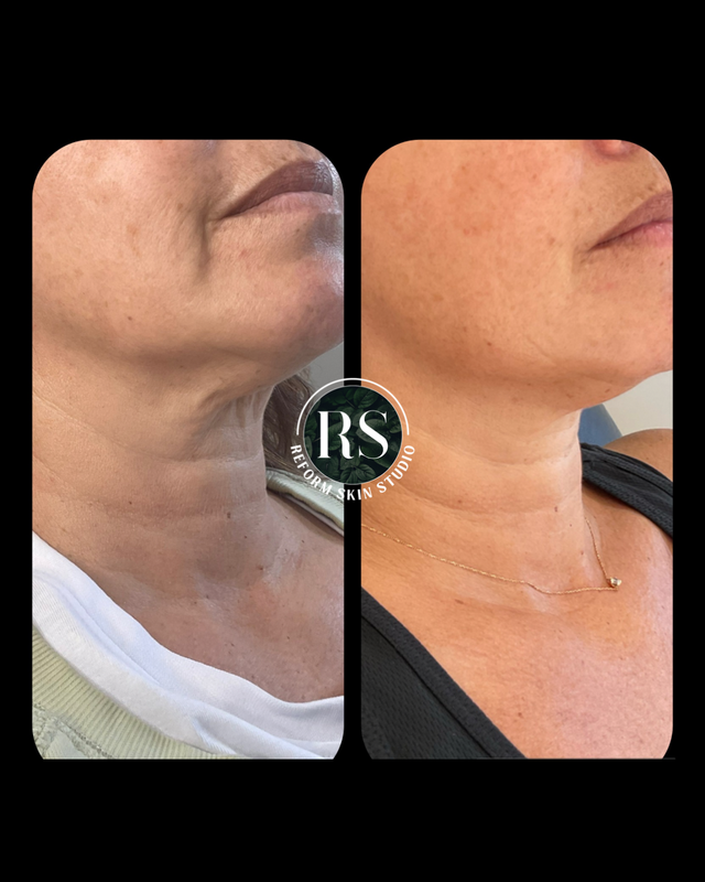 Client before and after image 7