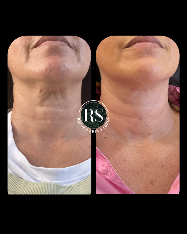 Client before and after image 8