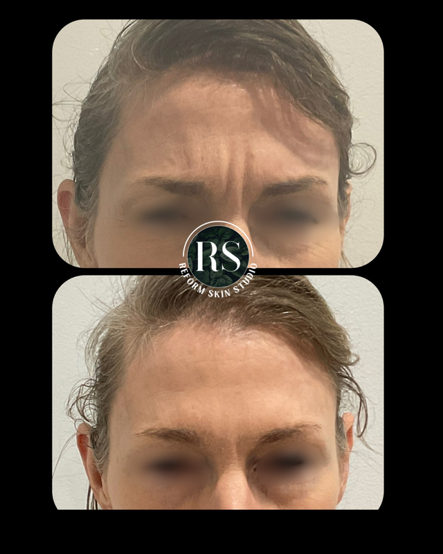 Client before and after image 9