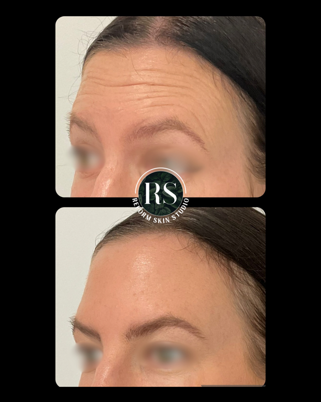 Client before and after image 10