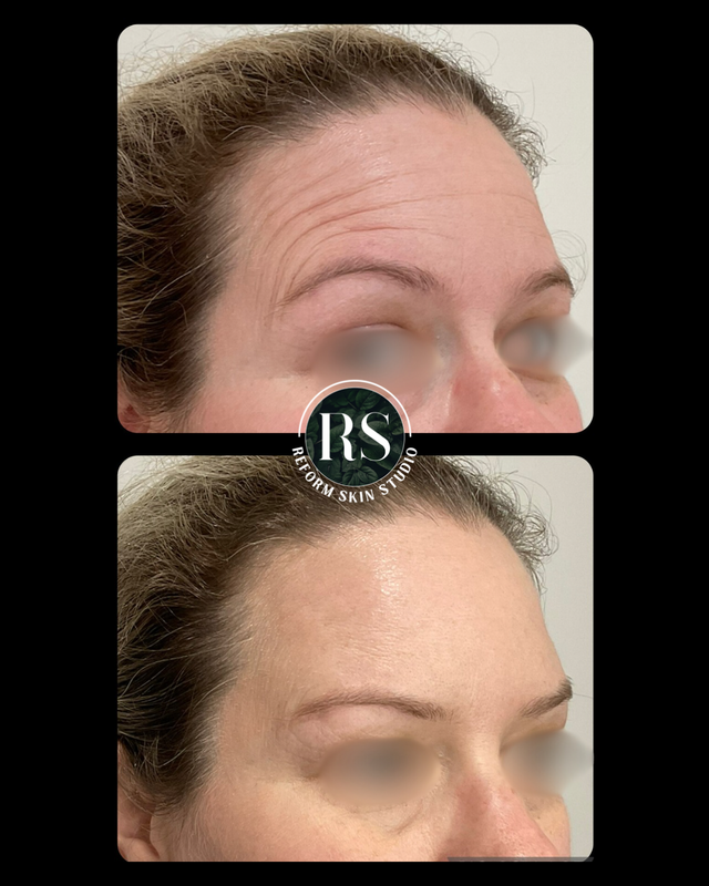 Client before and after image 11