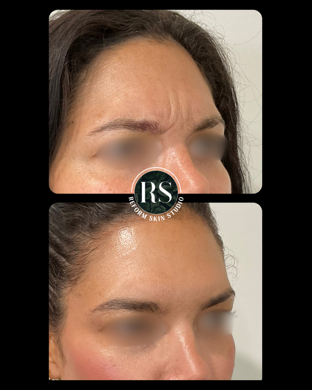 Client before and after image 12